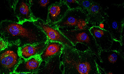 Human feto-placental endothelial cells (HPEC)