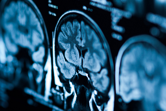 Tomographiebilder eines Gehirns.