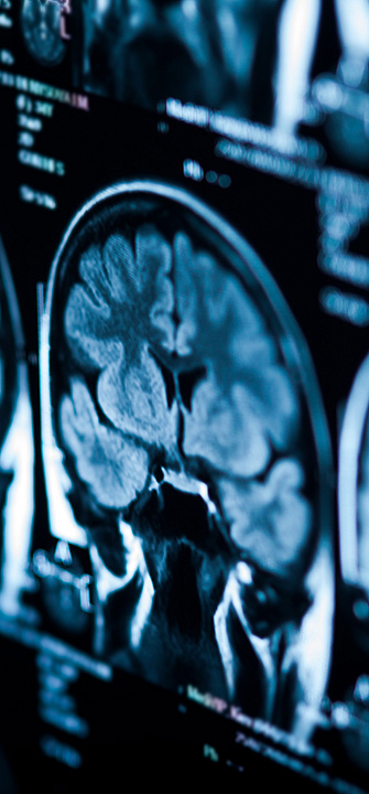 Images from a brain scan