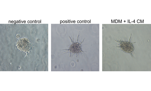 3D sprouting of primary human microvascular endothelial cells. Conditioned medium (CM) from human IL-4 polarized monocyte-derived macrophages potentiates HPMEC sprouting. 