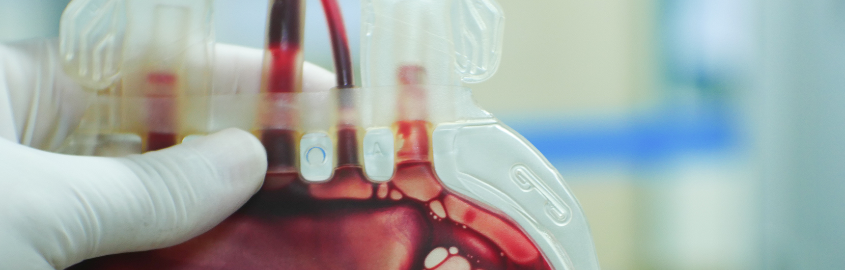 Blutgruppenserologie und Transfusionsmedizin
