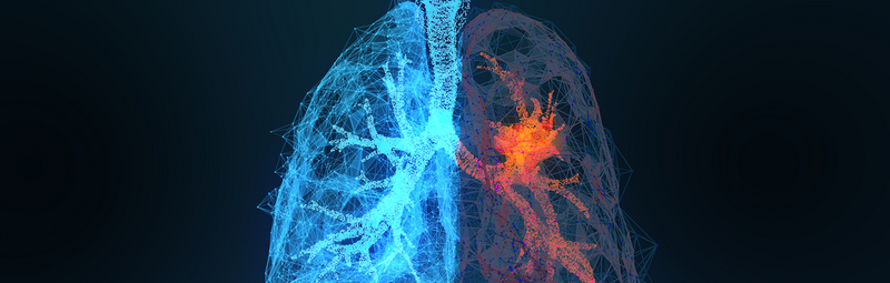 Lungenkrebs - appledesign/stock.adobe.com