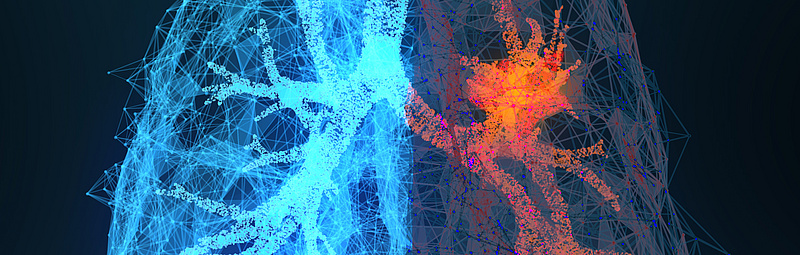 3D-gerenderte Illustration von Lungenkrebs