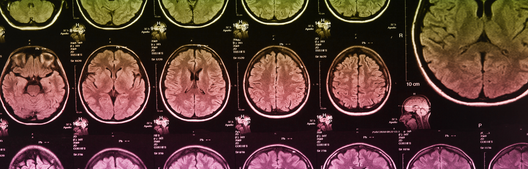 Neuroanaesthesiologischer Praxiskurs