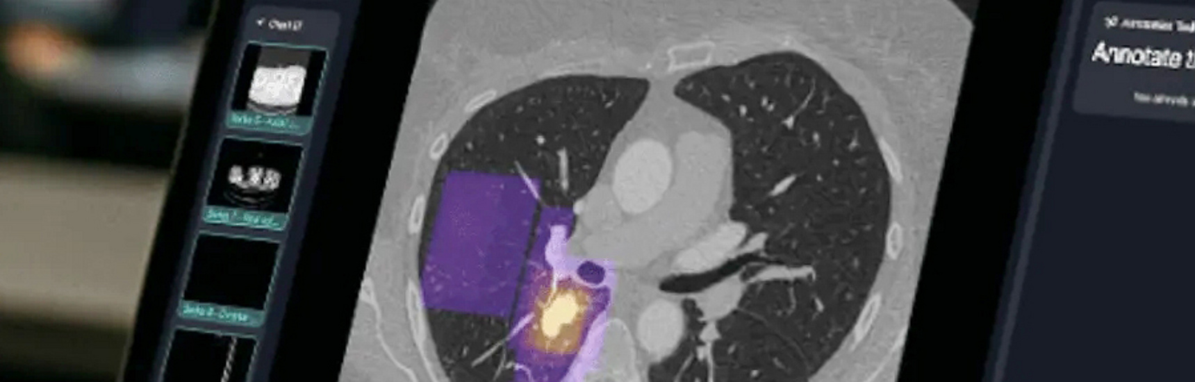 Lehre Kinderradiologie
