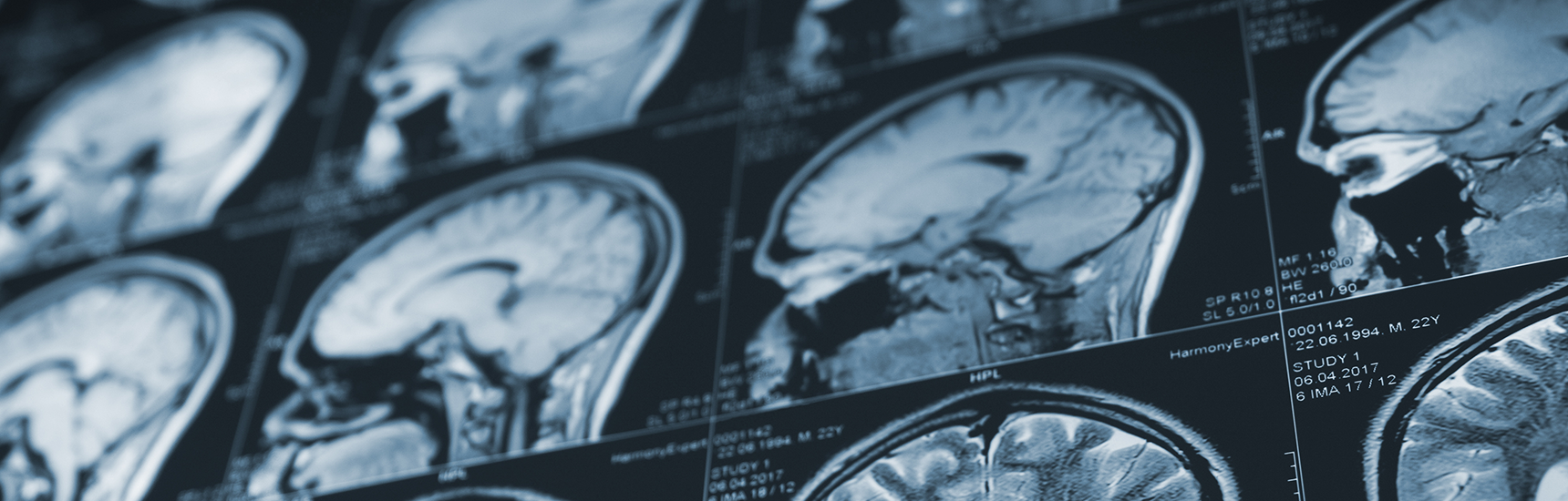 Neuroradiologie, vaskuläre und interventionelle Radiologie