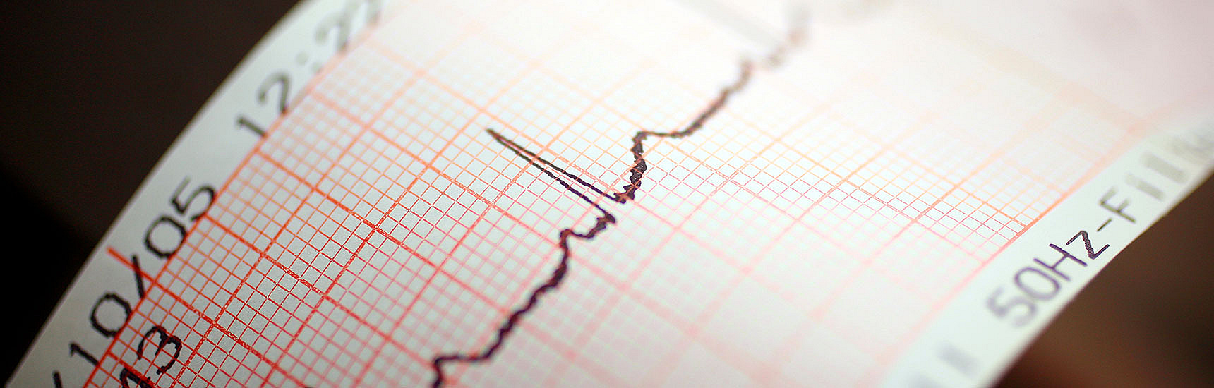 EKG - emeraldfoto/AdobeStock