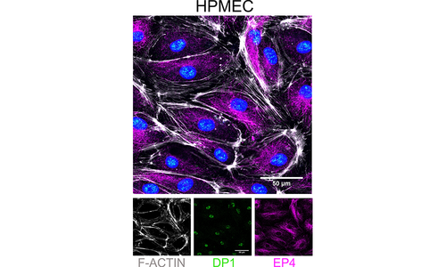 EP4 and DP1 receptor staining on primary human microvascular endothelial cells. 