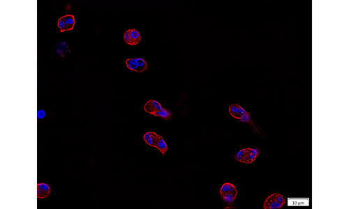 Aufgereinigte eosinophile Granulozyten, gefärbt auf fibrilläres Aktin und DNA.