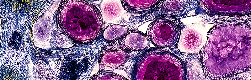 Licht aktiviert Chemotherapie gezielt am Tumor