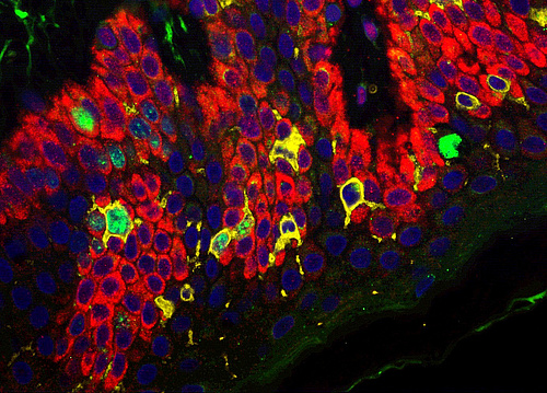 Langerhans Zellen in der menschlichen Oberhaut (Foto: Carmen Tam-Amersdorfer)