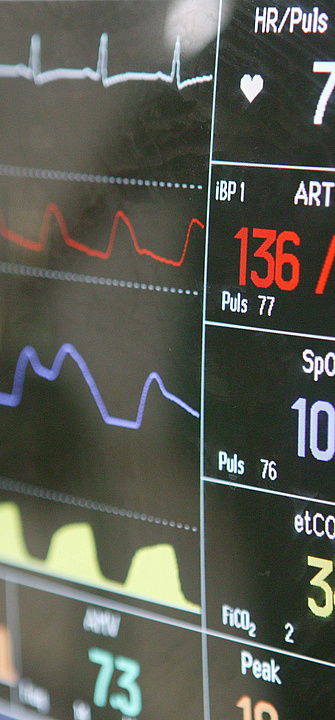 Auf einem Monitor werden Vitalzeichen wie Puls, Suaerstoffsättigung und Blutdruck angezeigt.