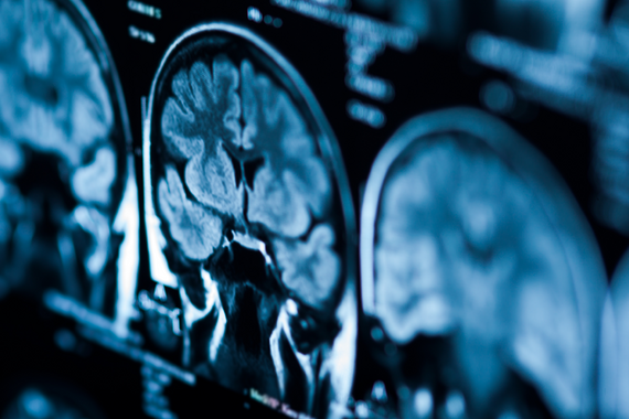 Neuroanaesthesiologischer Praxiskurs