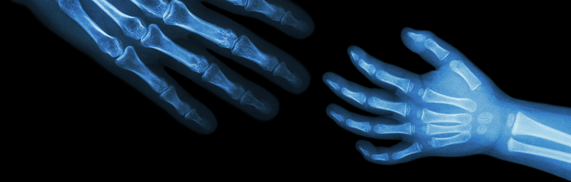 Zwei Hände im Röntgenbild