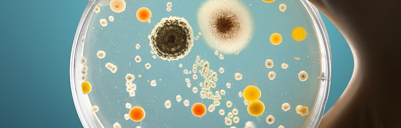Eine Hand hält eine Petrischale, auf der eine Vielzahl unterschiedlicher Mikroorganismen wachsen