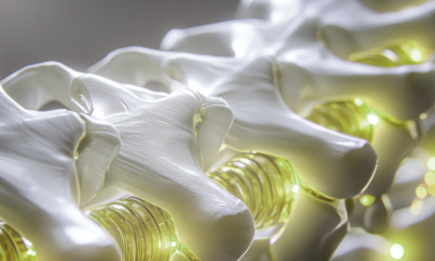 sunde Knochen – stark durchs Leben: Informationstag rund um Osteoporose