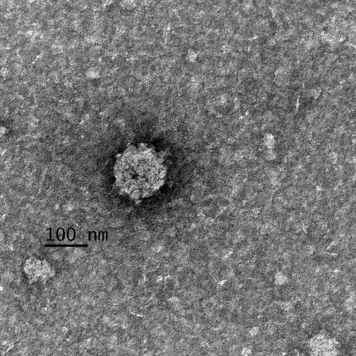 SARS-CoV-2 Virus unter dem Mikroskop