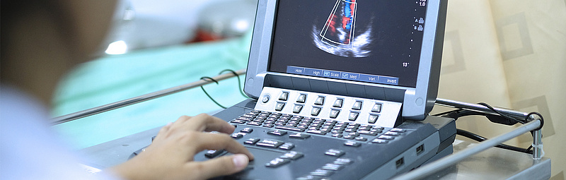 Echokardiographie - adobestock.com